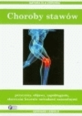 Choroby stawów - Leibold Gerhard