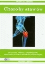 Choroby stawów