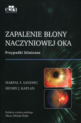 Zapalenie błony naczyniowej oka - H.S. Sandhu, H. J. Kaplan