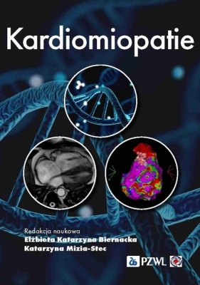 Kardiomiopatie - Katarzyna Mizia-Stec, Elżbieta Katarzyna Biernacka