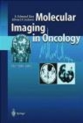 Molecular Imaging in Oncology