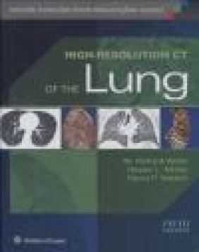High-Resolution CT of the Lung Nestor Muller, W.Richard Webb, David Naidich