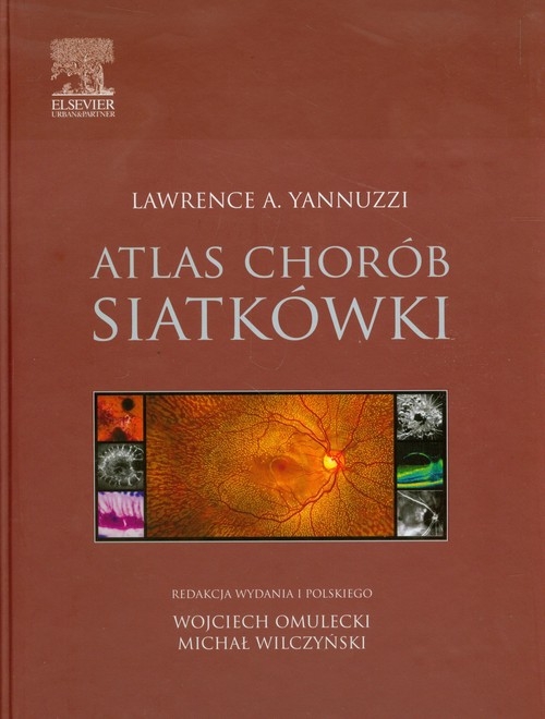 Atlas chorób siatkówki