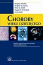 Choroby wieku dziecięcego - Stephen D. Marks, Peter K. Smith, Stephan Strobel