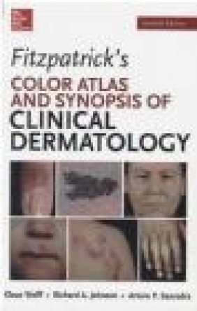 Fitzpatricks Color Atlas and Synopsis of Clinical Dermatology Klaus Wolff, Richard Allen Johnson
