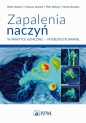 Zapalenia naczyń w praktyce klinicznej interdyscyplinarnie - Rafał Małecki, Mariusz Kusztal, Piotr Wiland, Marek Brzosko
