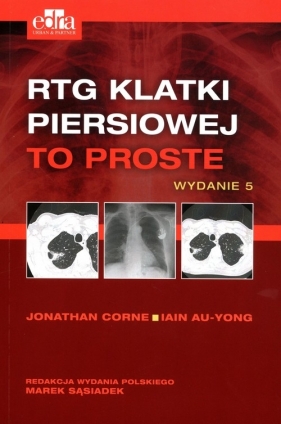 RTG klatki piersiowej To proste - I Au-Jong, Jonathan Corne