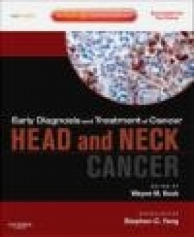 Head and Neck Cancers Wayne Koch