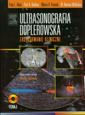 Ultrasonografia doplerowska Zastosowanie kliniczne Tom 1 z płytą DVD - Allan Paul L., Dubbins Paul A., Pozniak Myron A., McDicken W. Norman<br />