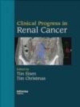 Clinical Progress in Renal Cancer Eisen
