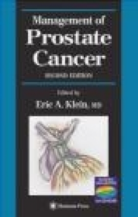 Management of Prostate Cancer Klein