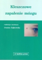 Kleszczowe zapalenie mózgu - Joanna Maria Zajkowska