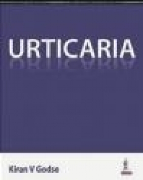 Urticaria