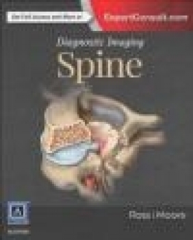 Diagnostic Imaging: Spine Kevin Moore, Jeffrey Ross