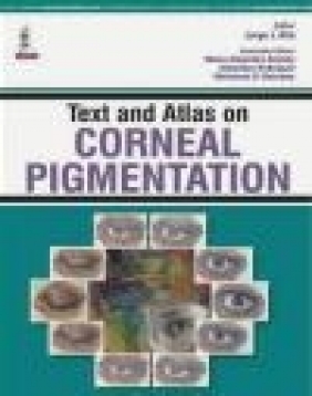 Text and Atlas on Corneal Pigmentation Alejandra Rodriguez, Maria Alejandra Amesty, Jorge Alio