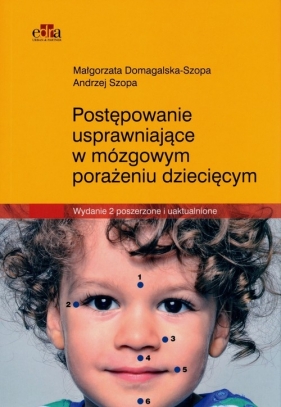Postępowanie usprawniające w mózgowym porażeniu dziecięcym - Domagalska-Szopa M., Szopa A.
