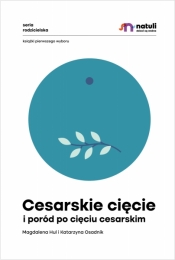 Cesarskie cięcie i poród po cięciu cesarskim