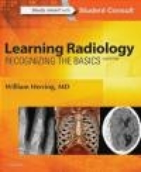 Learning Radiology William Herring
