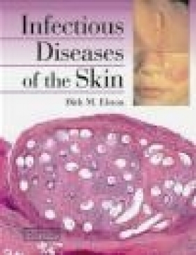 Infectious Diseases of the Skin Tammie Ferringer, Stephen K. Tyring, Omar P. Sangueza