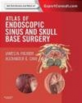 Atlas of Endoscopic Sinus and Skull Base Surgery Alexander G. Chiu, David W. Kennedy, James N. Palmer