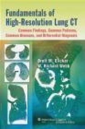Fundamentals of High-resolution Lung CT: Common Findings, Common Patterns, Common Diseases, and Diff