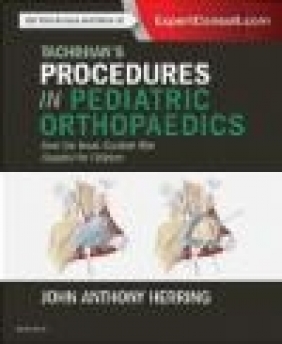 Tachdjian's Procedures in Pediatric Orthopaedics John Herring