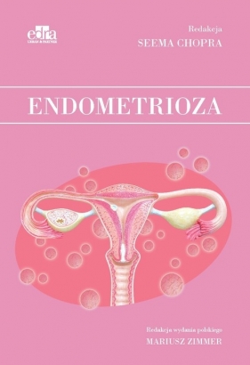 Endometrioza - Seema Chopra