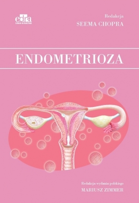 Endometrioza - Chopra S.