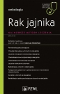 Rak jajnika Najnowsze metody leczenia - Opracowanie zbiorowe