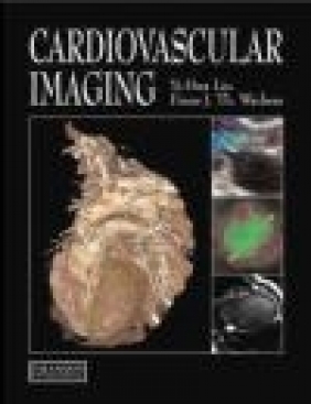 Cardiovascular Imaging Yi-Hwa Liu, Frans J. Wackers, Y Liu