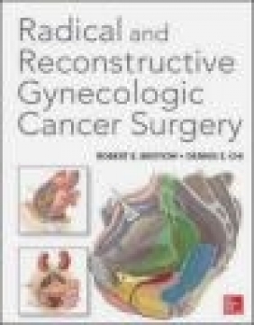 Radical and Reconstructive Gynecologic Cancer Surgery Dennis Chi, Robert Bristow