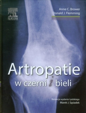 Artropatie w czerni i bieli - Anne C. Brower, Donald J. Flemming