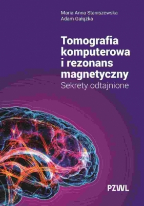 Tomografia komputerowa i rezonans magnetyczny. Sekrety odtajnione - Adam Gałązka