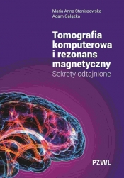 Tomografia komputerowa i rezonans magnetyczny - Staniszewska Maria Anna, Gałązka Adam