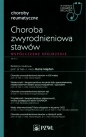Choroba zwyrodnieniowa stawów