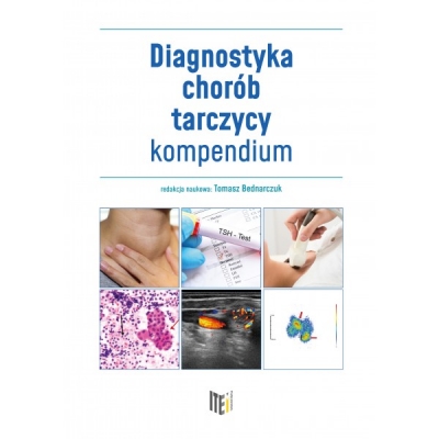 Diagnostyka chorób tarczycy - kompendium