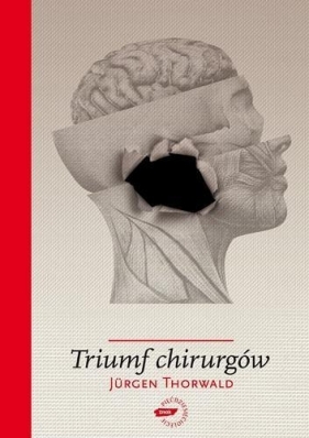 Triumf chirurgów (Uszkodzona okładka) - Thorwald Jürgen