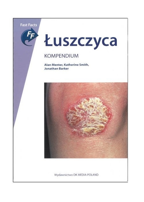 Łuszczyca Kompendium