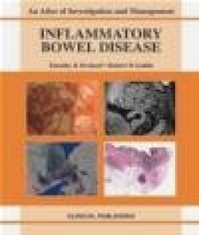 Inflammatory Bowel Disease Paris Tekkis, Horace Williams, Rob Goldin