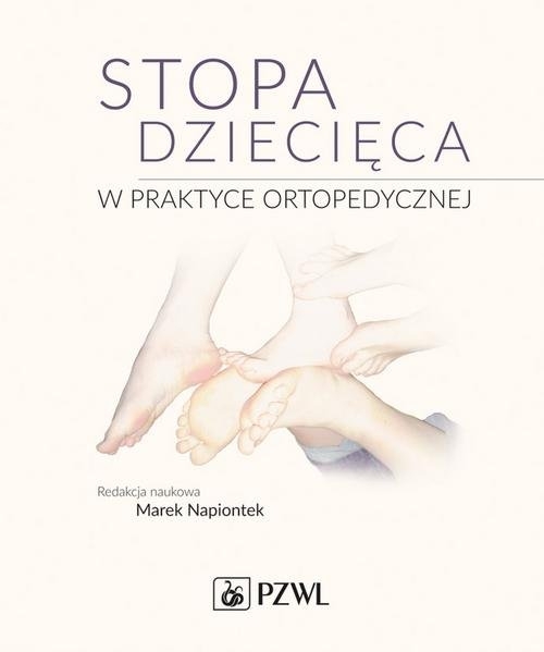 Stopa dziecięca w praktyce ortopedycznej