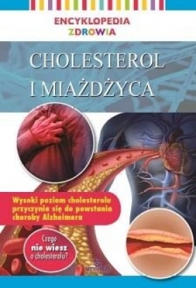 Encyklopedia zdrowia. Cholesterol i miażdżyca - Opracowanie zbiorowe