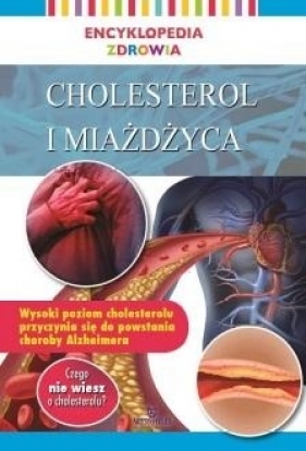 Encyklopedia zdrowia. Cholesterol i miażdżyca - Praca zbiorowa