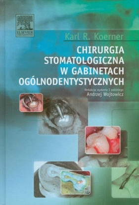 Chirurgia stomatologiczna w gabinetach ogólnodentystycznych - Karl R. Koerner