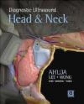 Diagnostic Ultrasound: Head and Neck Anil Ahuja