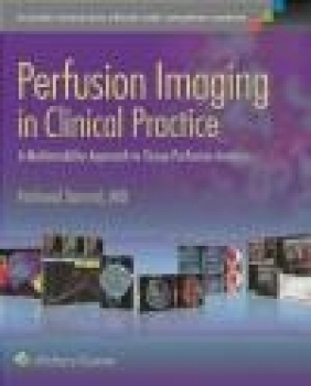 Perfusion Imaging in Clinical Practice