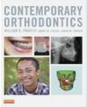 Contemporary Orthodontics Henry W. Fields, David M. Sarver, William R. Proffit
