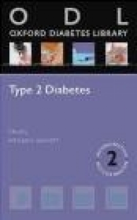 Type 2 Diabetes - Tony Barnett