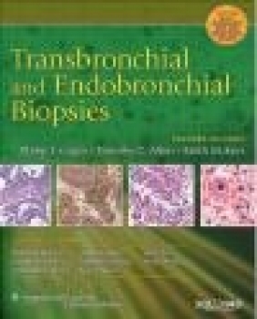 Transbronchial and Endobronchial Biopsies Philip T. Cagle, P Cagle