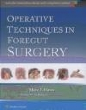 Operative Techniques in Foregut Surgery Mary Hawn