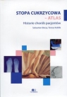 Stopa cukrzycowa - atlas Historie chorób pacjentów Borys Sebastian, Koblik Teresa
